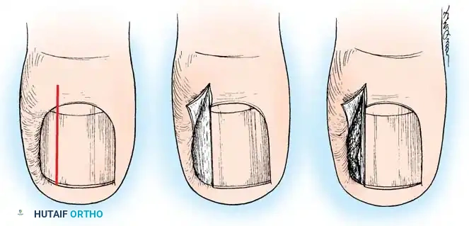 Hutaifortho's Orthopaedic Diagram