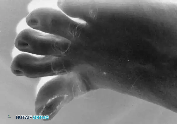 Hutaifortho's Orthopaedic Diagram