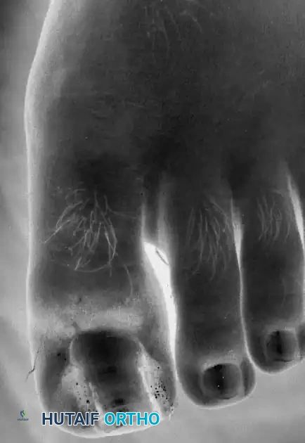 Hutaifortho's Orthopaedic Diagram