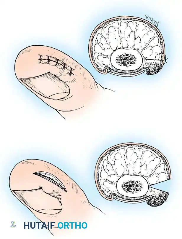Hutaifortho's Orthopaedic Diagram