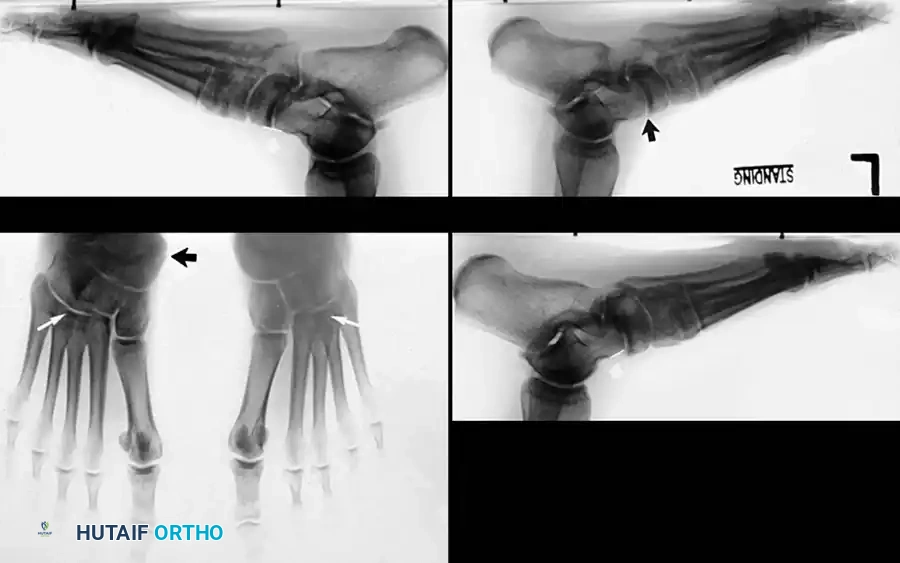 Hutaifortho's Orthopaedic Diagram