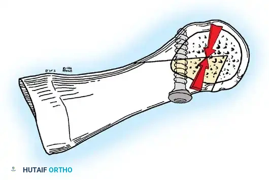 Disorders of the Hallux Surgical Diagram