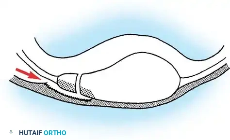 Disorders of the Patella: Diagnosis and Surgical Management