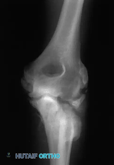 Hutaifortho's Orthopaedic Diagram