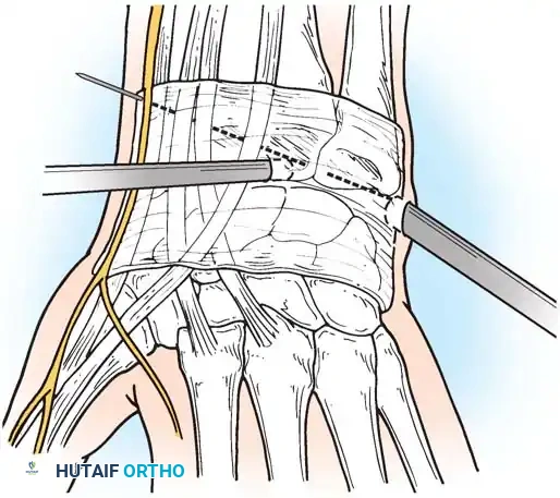 Hutaifortho's Orthopaedic Diagram