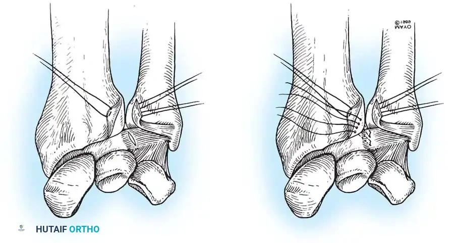 Hutaifortho's Orthopaedic Diagram