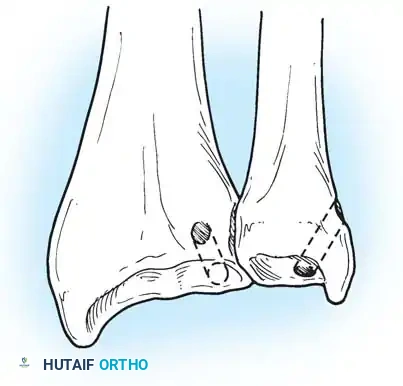 Hutaifortho's Orthopaedic Diagram