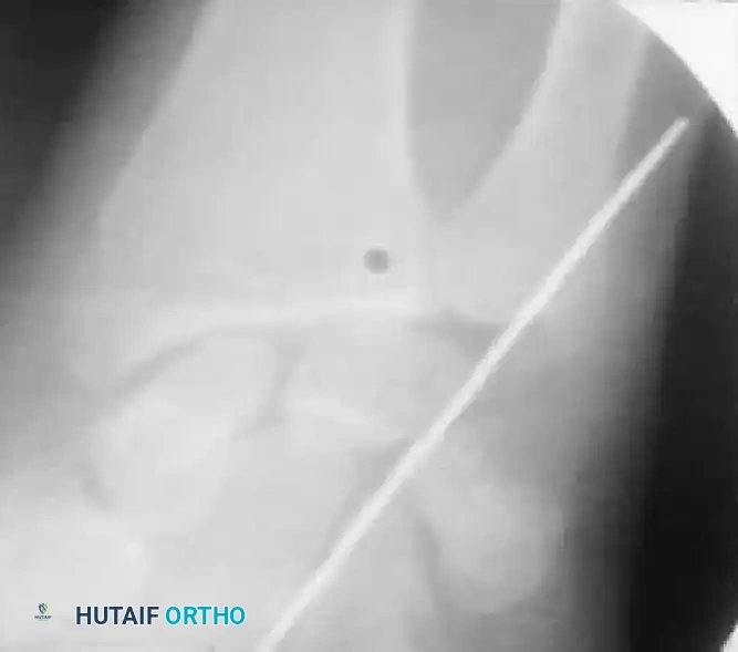 Hutaifortho's Orthopaedic Diagram