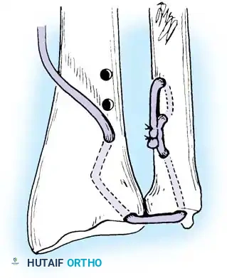 Hutaifortho's Orthopaedic Diagram