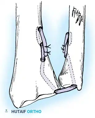 Hutaifortho's Orthopaedic Diagram