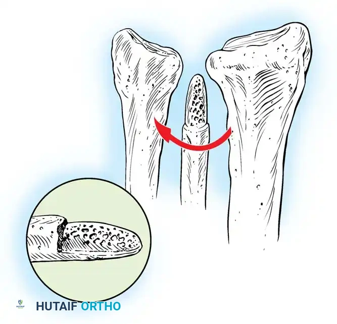 Hutaifortho's Orthopaedic Diagram