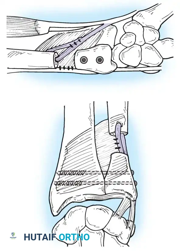 Hutaifortho's Orthopaedic Diagram