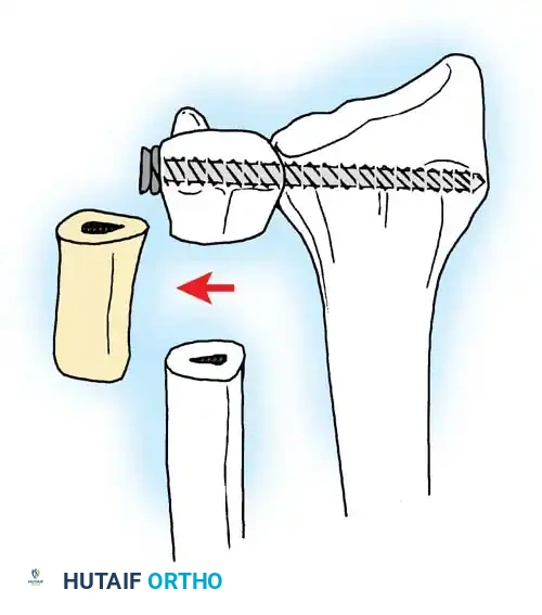 Hutaifortho's Orthopaedic Diagram