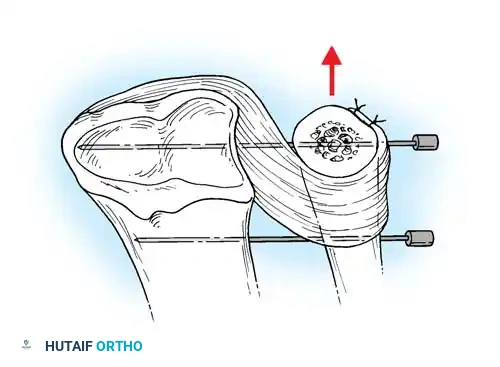 Hutaifortho's Orthopaedic Diagram