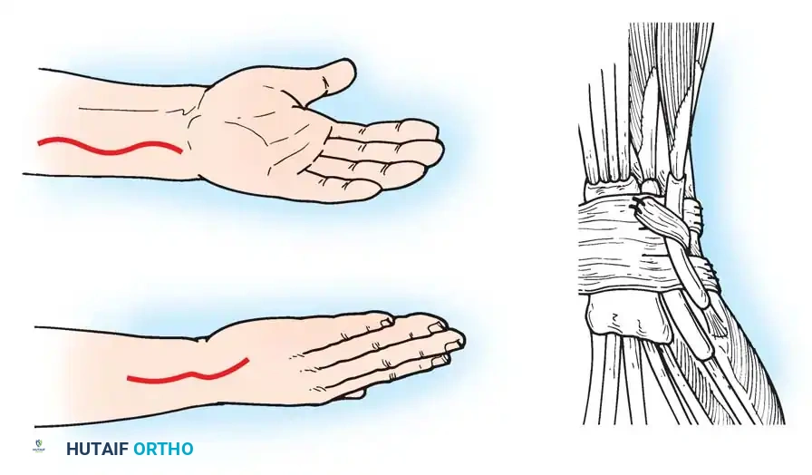 Hutaifortho's Orthopaedic Diagram