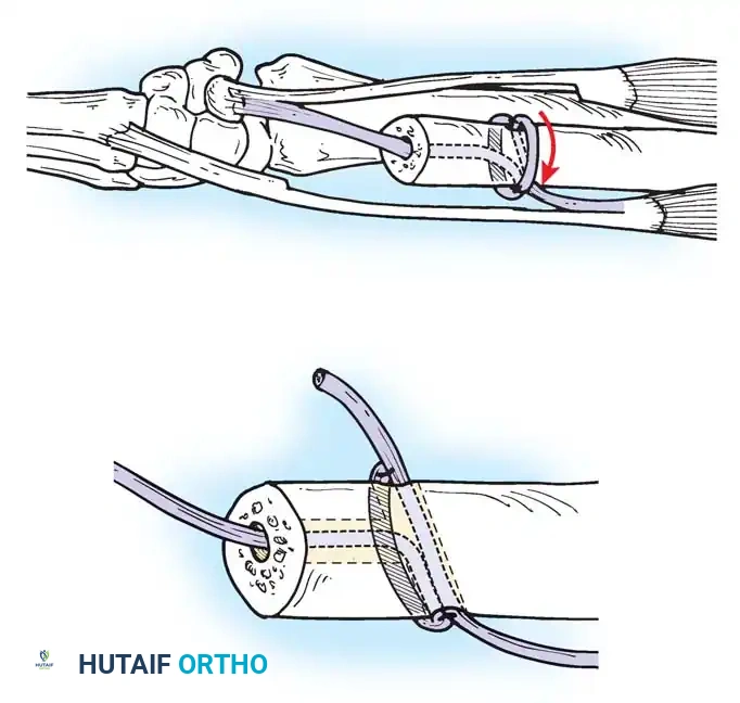 Hutaifortho's Orthopaedic Diagram