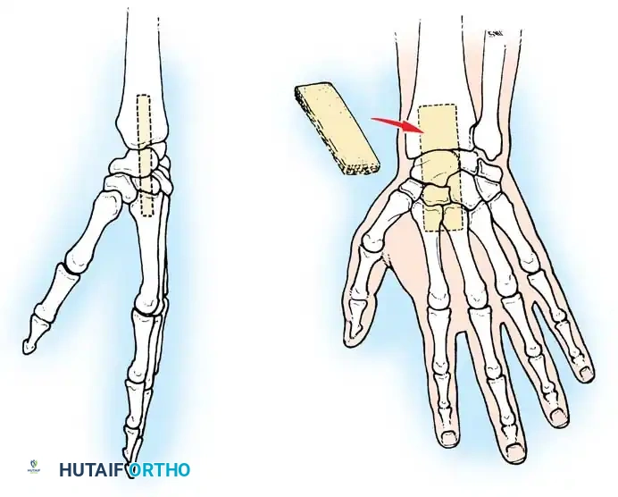 Hutaifortho's Orthopaedic Diagram