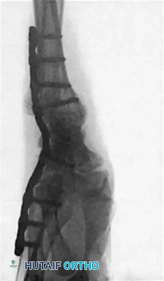Hutaifortho's Orthopaedic Diagram