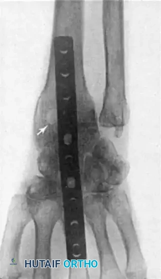 Hutaifortho's Orthopaedic Diagram