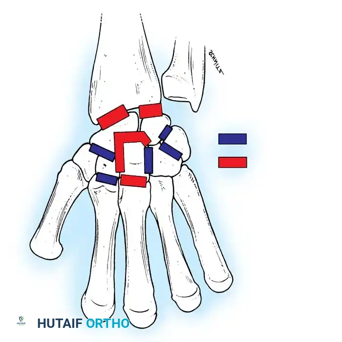 Hutaifortho's Orthopaedic Diagram