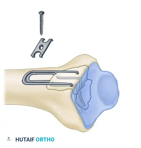 Hutaifortho's Orthopaedic Diagram