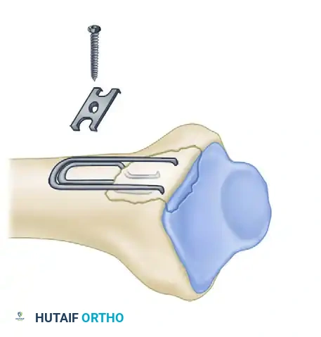 Hutaifortho's Orthopaedic Diagram