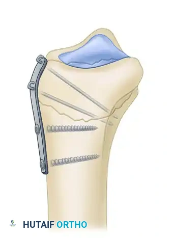 Hutaifortho's Orthopaedic Diagram