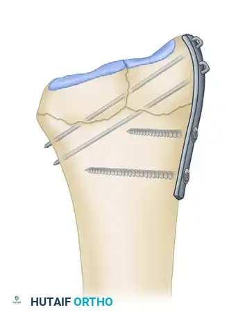 Hutaifortho's Orthopaedic Diagram