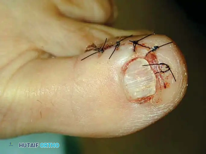 Hutaifortho's Orthopaedic Diagram