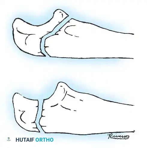 Hutaifortho's Orthopaedic Diagram