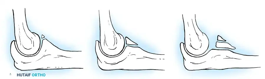 Hutaifortho's Orthopaedic Diagram