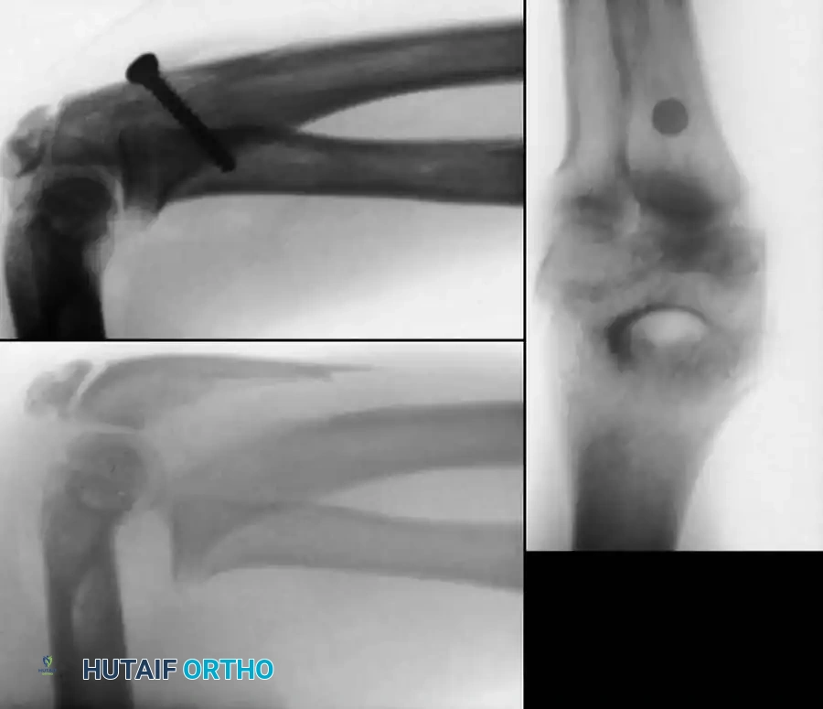 Hutaifortho's Orthopaedic Diagram