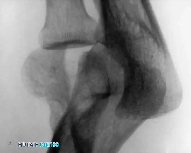 Hutaifortho's Orthopaedic Diagram