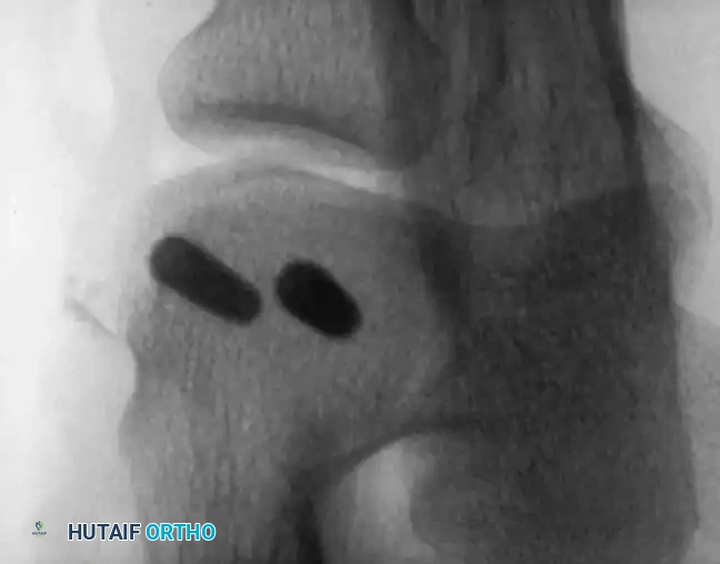 Operative Orthopaedics Clinical Reference