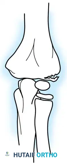 Hutaifortho's Orthopaedic Diagram
