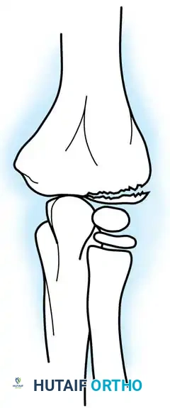 Hutaifortho's Orthopaedic Diagram