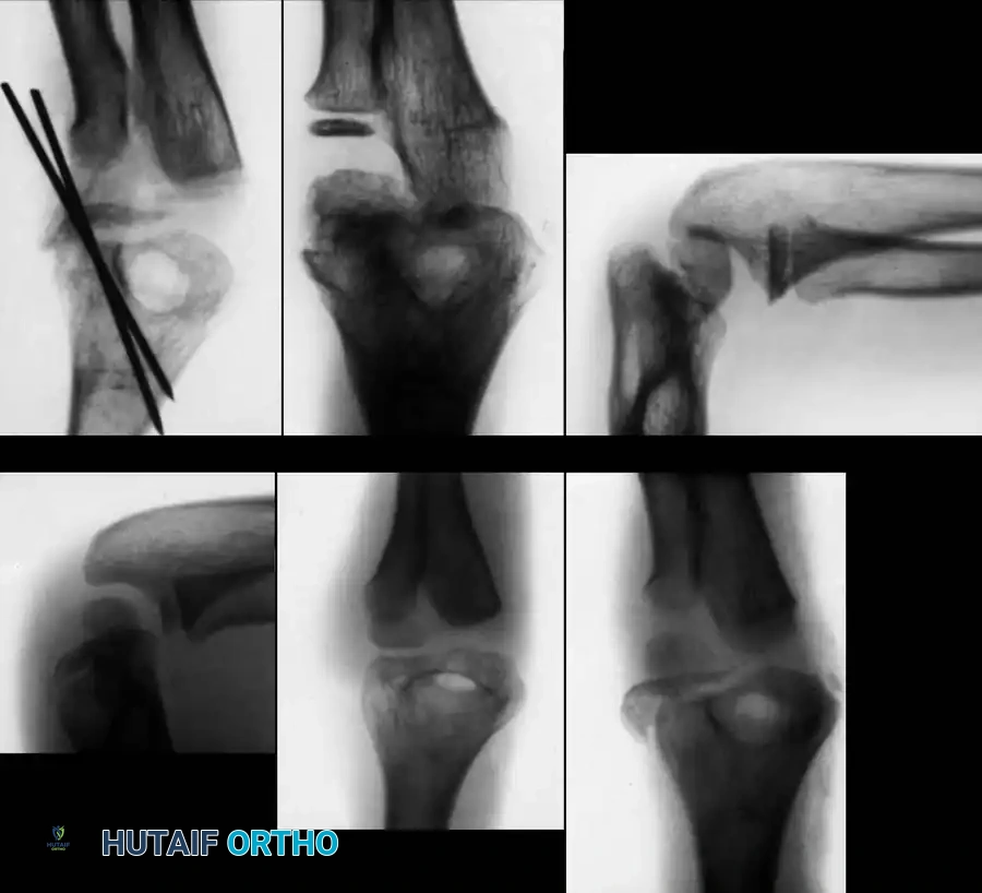 Hutaifortho's Orthopaedic Diagram