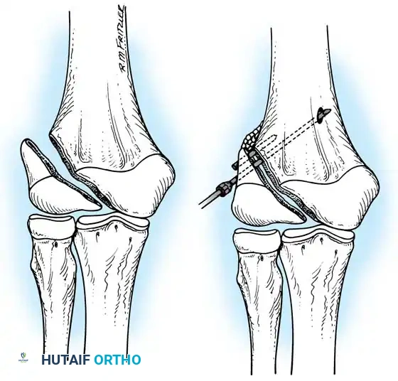 Hutaifortho's Orthopaedic Diagram