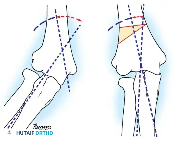Hutaifortho's Orthopaedic Diagram