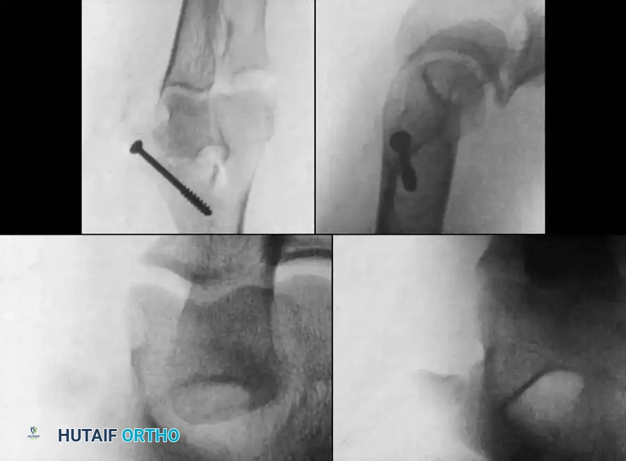 Operative Orthopaedics Clinical Reference