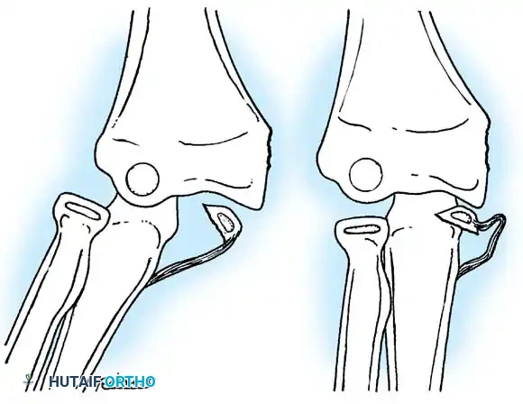 Hutaifortho's Orthopaedic Diagram