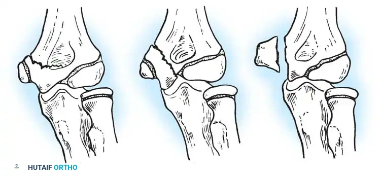 Hutaifortho's Orthopaedic Diagram