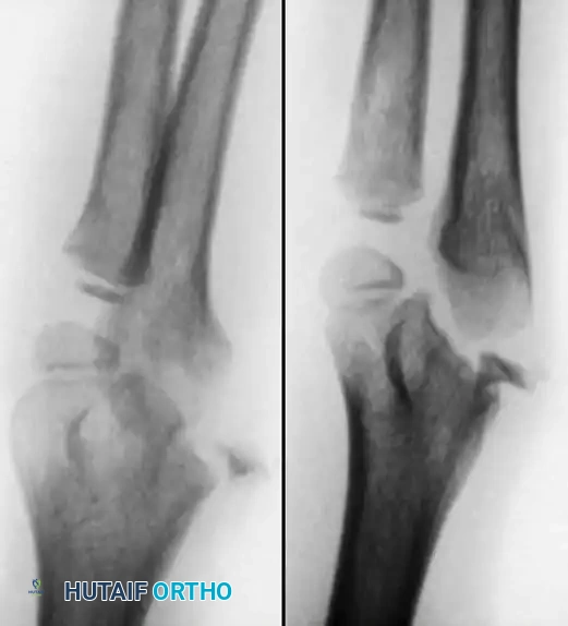 Hutaifortho's Orthopaedic Diagram
