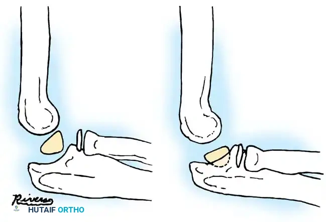 Hutaifortho's Orthopaedic Diagram