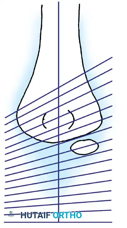 Hutaifortho's Orthopaedic Diagram