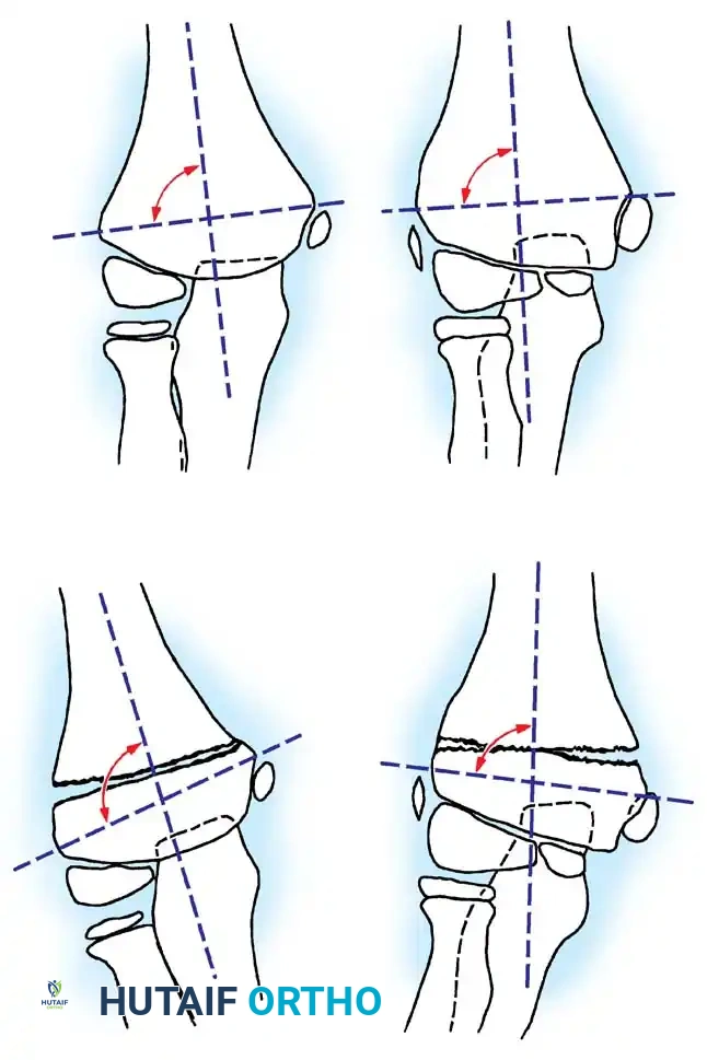 Hutaifortho's Orthopaedic Diagram