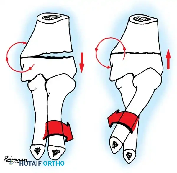 Operative Orthopaedics Clinical Reference