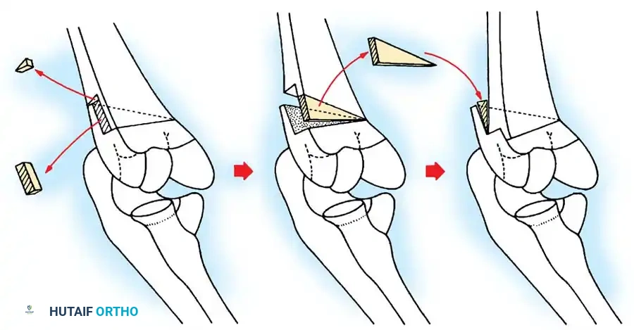 Hutaifortho's Orthopaedic Diagram