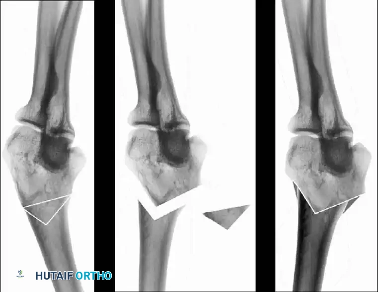 Operative Orthopaedics Clinical Reference