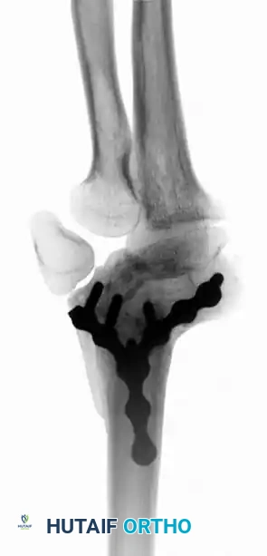 Hutaifortho's Orthopaedic Diagram